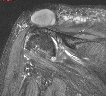 Figure 4 for case Geyser phenomenon